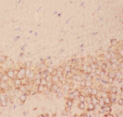 Invitrogen FSH beta Polyclonal Antibody 100 &mu;g; Unconjugated:Antibodies,