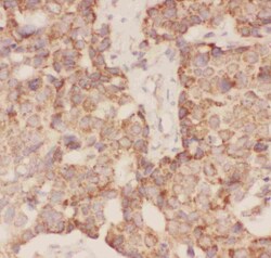 Invitrogen FSH beta Polyclonal Antibody 100 &mu;g; Unconjugated:Antibodies,