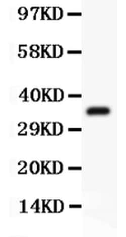 Invitrogen FSH beta Polyclonal Antibody 100 &mu;g; Unconjugated:Antibodies,