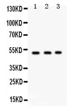 Invitrogen FUT1 Polyclonal Antibody 100 &mu;g; Unconjugated:Antibodies,