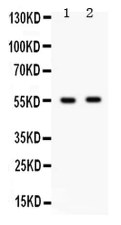 Invitrogen GABRB3 Polyclonal Antibody 100 &mu;g; Unconjugated:Antibodies,