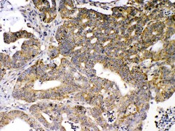 Invitrogen GAD65 Polyclonal Antibody 100 &mu;g; Unconjugated:Antibodies,