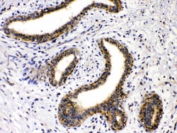 Invitrogen GAD65 Polyclonal Antibody 100 &mu;g; Unconjugated:Antibodies,