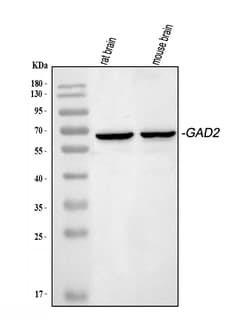 Invitrogen GAD65 Polyclonal Antibody 100 &mu;g; Unconjugated:Antibodies,
