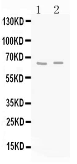 Invitrogen GAD65 Polyclonal Antibody 100 &mu;g; Unconjugated:Antibodies,