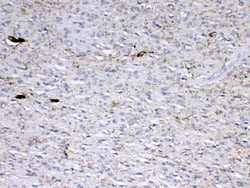 Invitrogen GAD65 Polyclonal Antibody 100 &mu;g; Unconjugated:Antibodies,