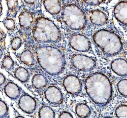 GALT Polyclonal Antibody:Antibodies, Polyclonal