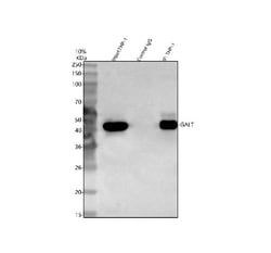 GALT Polyclonal Antibody:Antibodies, Polyclonal