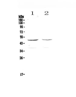 GALT Polyclonal Antibody:Antibodies, Polyclonal