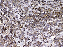 Invitrogen GC Polyclonal Antibody 100 &mu;g; Unconjugated:Antibodies, Polyclonal