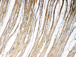 Invitrogen Connexin 45 Polyclonal Antibody 100 &mu;g; Unconjugated:Antibodies,