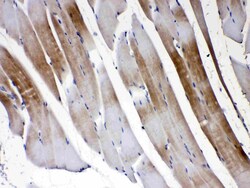 Invitrogen Connexin 45 Polyclonal Antibody 100 &mu;g; Unconjugated:Antibodies,
