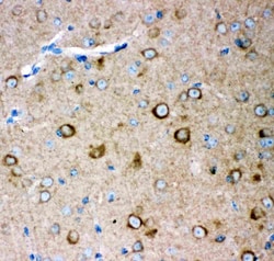 Invitrogen GluR2 Polyclonal Antibody 100 &mu;g; Unconjugated:Antibodies,