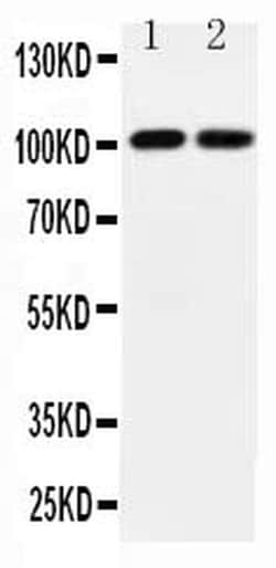 Invitrogen GluR3 Polyclonal Antibody 100 &mu;g; Unconjugated:Antibodies,