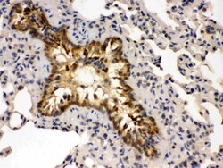 Invitrogen GRK5 Polyclonal Antibody 100 &mu;g; Unconjugated:Antibodies,