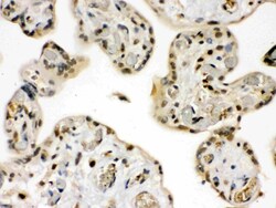 Invitrogen GRK5 Polyclonal Antibody 100 &mu;g; Unconjugated:Antibodies,