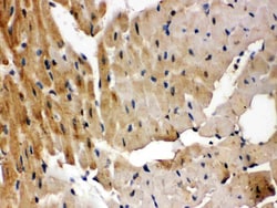 Invitrogen GRK5 Polyclonal Antibody 100 &mu;g; Unconjugated:Antibodies,
