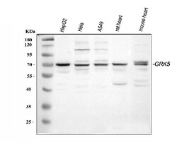 Invitrogen GRK5 Polyclonal Antibody 100 &mu;g; Unconjugated:Antibodies,