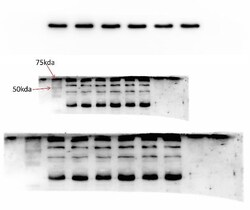 Invitrogen GRK5 Polyclonal Antibody 100 &mu;g; Unconjugated:Antibodies,