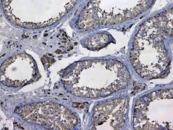 Invitrogen GSTM3 Polyclonal Antibody 100 &mu;g; Unconjugated:Antibodies,