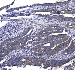 Invitrogen GSTM3 Polyclonal Antibody 100 &mu;g; Unconjugated:Antibodies,