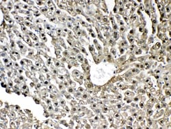 Invitrogen GSTP1 Polyclonal Antibody 100 &mu;g; Unconjugated:Antibodies,