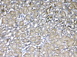 Invitrogen GSTP1 Polyclonal Antibody 100 &mu;g; Unconjugated:Antibodies,