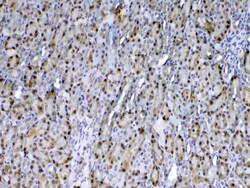 Invitrogen GSTP1 Polyclonal Antibody 100 &mu;g; Unconjugated:Antibodies,