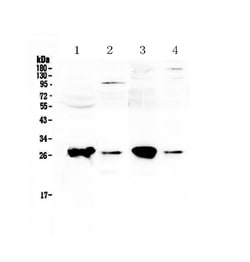 Invitrogen GSTT1 Polyclonal Antibody 100 &mu;g; Unconjugated:Antibodies,