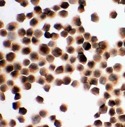 Invitrogen KIM-1 Polyclonal Antibody 100 &mu;g; Unconjugated:Antibodies,