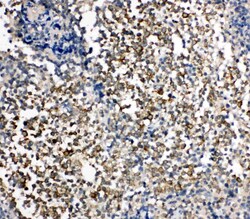 Invitrogen KIM-1 Polyclonal Antibody 100 &mu;g; Unconjugated:Antibodies,