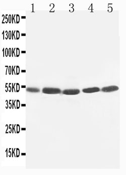 Invitrogen KIM-1 Polyclonal Antibody 100 &mu;g; Unconjugated:Antibodies,