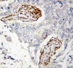 Invitrogen HDAC8 Polyclonal Antibody 100 &mu;g; Unconjugated:Antibodies,