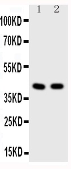 Invitrogen HDAC8 Polyclonal Antibody 100 &mu;g; Unconjugated:Antibodies,