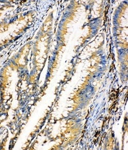 Invitrogen HEXA Polyclonal Antibody 100 &mu;g; Unconjugated:Antibodies,