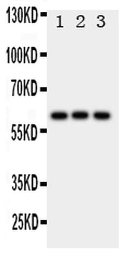 Invitrogen HEXA Polyclonal Antibody 100 &mu;g; Unconjugated:Antibodies,