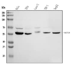 Invitrogen HEXA Polyclonal Antibody 100 &mu;g; Unconjugated:Antibodies,