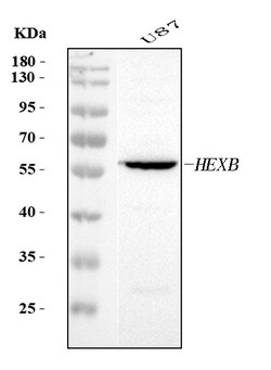 Invitrogen HEXB Polyclonal Antibody 100 &mu;g; Unconjugated:Antibodies,