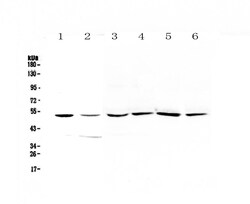 Invitrogen HGD Polyclonal Antibody 100 &mu;g; Unconjugated:Antibodies,