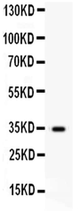 Invitrogen HGF Polyclonal Antibody 100 &mu;g; Unconjugated:Antibodies,