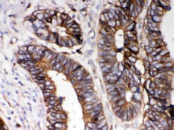 Invitrogen HLA-A Polyclonal Antibody 100 &mu;g; Unconjugated:Antibodies,