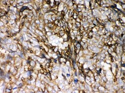 Invitrogen HLA-C Polyclonal Antibody 100 &mu;g | Buy Online | Invitrogen&trade; | Fisher Scientific