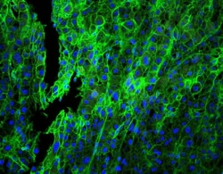 Invitrogen HLA-C Polyclonal Antibody 100 &mu;g | Buy Online | Invitrogen&trade; | Fisher Scientific