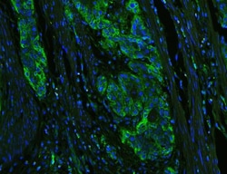 Invitrogen HLA-C Polyclonal Antibody 100 &mu;g | Buy Online | Invitrogen&trade; | Fisher Scientific