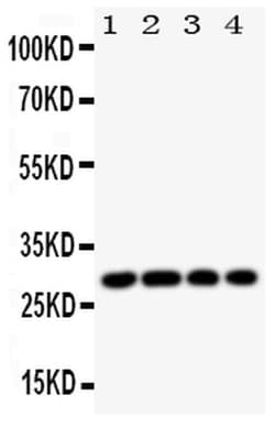 Invitrogen HLA-DMB Polyclonal Antibody 100 &mu;g | Buy Online | Invitrogen&trade; | Fisher Scientific