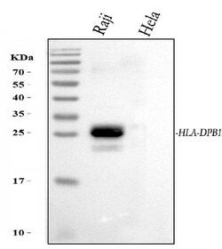 Invitrogen HLA-DPB1 Polyclonal Antibody 100 &mu;g | Buy Online | Invitrogen&trade; | Fisher Scientific