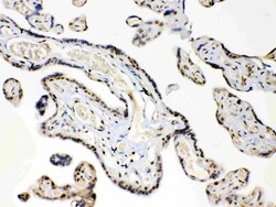 Invitrogen HMGB1 Polyclonal Antibody 100 &mu;g; Unconjugated:Antibodies,