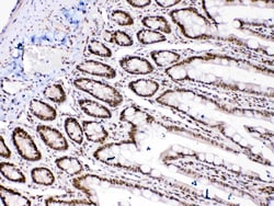 Invitrogen HMGB1 Polyclonal Antibody 100 &mu;g; Unconjugated:Antibodies,