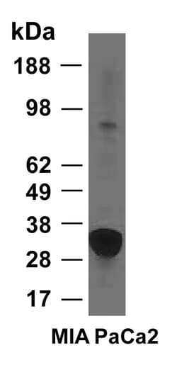 Invitrogen HO-1 Polyclonal Antibody 100 &mu;g; Unconjugated:Antibodies,