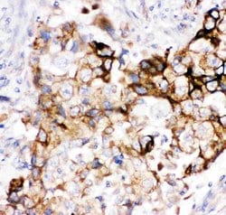 Invitrogen Heme oxygenase 2 Polyclonal Antibody 100 &mu;g; Unconjugated:Antibodies,